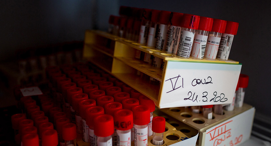 I campioni sottoposti al test sul Coronavirus vengono conservati nella cella frigorifera